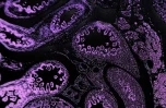 TME 肿瘤微环境建模与药物响应研究